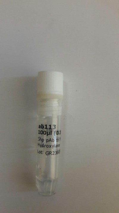 Anti-Tyrosine Hydroxylase antibody  ab113  100 µl