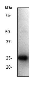 آنتی بادی نوترکیب Anti-HIV1 p24 [P131] (ab32352) بسته بندی 100 میکرولیتر